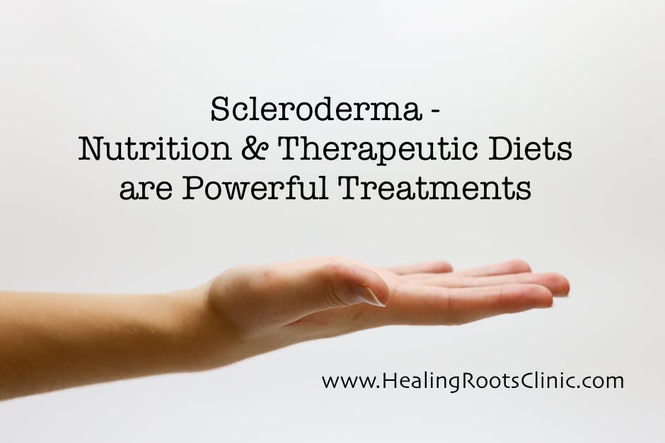 scleroderma therapeutic diet